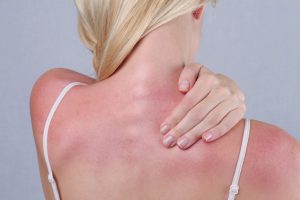 How to Refresh Sun Damaged Skin