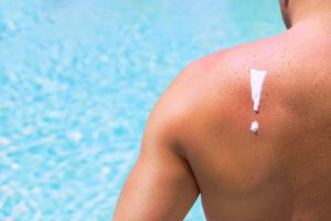 Skincare Tips for Sun Damage